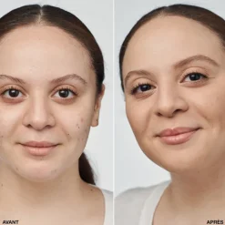 Even Better Clinical