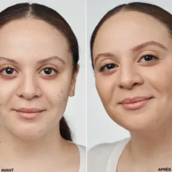 Even Better Clinical