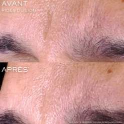 Rénergie C.R.x. Triple Sérum Rétinol