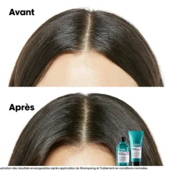 Scalp Advanced