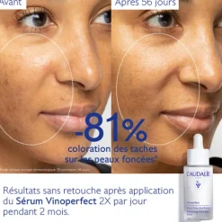 Sérum Éclat Anti-Taches