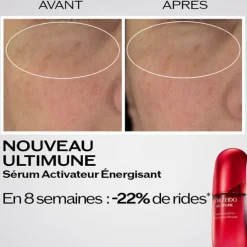 Ultimune